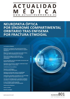 Neuropatía óptica por síndrome compartimental orbitario tras enfisema por fractura etmoidal